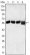 LCK Proto-Oncogene, Src Family Tyrosine Kinase antibody, MA5-15295, Invitrogen Antibodies, Western Blot image 