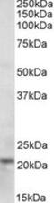 Ferritin Mitochondrial antibody, NBP1-06985, Novus Biologicals, Western Blot image 