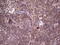 Protein Kinase D3 antibody, LS-C790661, Lifespan Biosciences, Immunohistochemistry paraffin image 