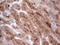 Colony Stimulating Factor 1 antibody, LS-C340007, Lifespan Biosciences, Immunohistochemistry paraffin image 