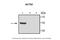 Actinin Alpha 1 antibody, 27-160, ProSci, Western Blot image 