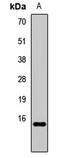 Hemoglobin Subunit Alpha 2 antibody, LS-C668581, Lifespan Biosciences, Western Blot image 