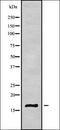 Chromodomain Helicase DNA Binding Protein 6 antibody, orb338178, Biorbyt, Western Blot image 