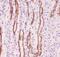 Solute Carrier Family 9 Member A1 antibody, PB9151, Boster Biological Technology, Immunohistochemistry paraffin image 