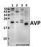 Arginine Vasopressin antibody, A00384, Boster Biological Technology, Western Blot image 