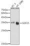 Growth Differentiation Factor 15 antibody, GTX54079, GeneTex, Western Blot image 