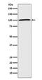 ATPase Na+/K+ Transporting Subunit Alpha 1 antibody, M00956, Boster Biological Technology, Western Blot image 