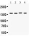 Patched 1 antibody, PB9352, Boster Biological Technology, Western Blot image 