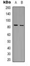 Amyloid Beta Precursor Protein Binding Family B Member 2 antibody, LS-C368881, Lifespan Biosciences, Western Blot image 