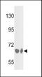 Complement Factor B antibody, GTX81508, GeneTex, Western Blot image 