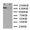 Erb-B2 Receptor Tyrosine Kinase 4 antibody, orb97008, Biorbyt, Western Blot image 