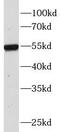 Immunoglobulin Heavy Constant Gamma 4 (G4m Marker) antibody, FNab09911, FineTest, Western Blot image 