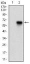 Calcium/Calmodulin Dependent Protein Kinase II Gamma antibody, NBP2-37269, Novus Biologicals, Western Blot image 