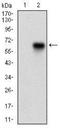Calcium/Calmodulin Dependent Protein Kinase II Gamma antibody, NBP2-37269, Novus Biologicals, Western Blot image 
