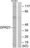 G Protein-Coupled Receptor 27 antibody, TA313949, Origene, Western Blot image 