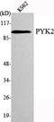 Protein Tyrosine Kinase 2 Beta antibody, STJ98544, St John