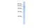 Interphotoreceptor Matrix Proteoglycan 2 antibody, A10288, Boster Biological Technology, Western Blot image 