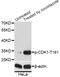 Cyclin Dependent Kinase 1 antibody, MBS128572, MyBioSource, Western Blot image 