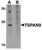 Tetraspanin 9 antibody, orb75338, Biorbyt, Western Blot image 