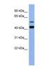 Zinc Finger Protein 547 antibody, NBP1-80283, Novus Biologicals, Western Blot image 