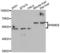 Proteasome 26S Subunit, Non-ATPase 5 antibody, LS-C348997, Lifespan Biosciences, Western Blot image 