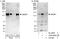 SUMO Specific Peptidase 7 antibody, A302-995A, Bethyl Labs, Immunoprecipitation image 