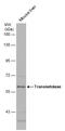 Transketolase antibody, GTX101477, GeneTex, Western Blot image 