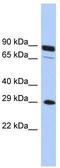 Homeobox C5 antibody, TA329259, Origene, Western Blot image 