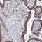 SH3 And PX Domains 2A antibody, NBP1-90455, Novus Biologicals, Immunohistochemistry paraffin image 