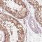 GRB10 Interacting GYF Protein 2 antibody, HPA065064, Atlas Antibodies, Immunohistochemistry paraffin image 