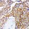 OB receptor antibody, GTX02830, GeneTex, Immunohistochemistry paraffin image 