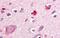 RAR Related Orphan Receptor B antibody, GTX70903, GeneTex, Immunohistochemistry paraffin image 