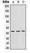 Cathepsin F antibody, MBS8214060, MyBioSource, Western Blot image 