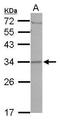 Coiled-Coil Domain Containing 127 antibody, GTX122888, GeneTex, Western Blot image 