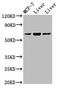 Parathyroid Hormone 1 Receptor antibody, LS-C670894, Lifespan Biosciences, Western Blot image 