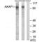 A-Kinase Anchoring Protein 1 antibody, A04451, Boster Biological Technology, Western Blot image 