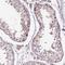 C6orf106 antibody, HPA034489, Atlas Antibodies, Immunohistochemistry paraffin image 