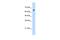 Zinc Finger Protein 326 antibody, PA5-41698, Invitrogen Antibodies, Western Blot image 