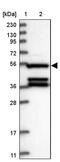 Secretion Regulating Guanine Nucleotide Exchange Factor antibody, PA5-58116, Invitrogen Antibodies, Western Blot image 