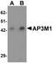 Adaptor Related Protein Complex 3 Subunit Mu 1 antibody, PA5-21162, Invitrogen Antibodies, Western Blot image 