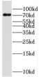 Arginyl Aminopeptidase antibody, FNab07370, FineTest, Western Blot image 