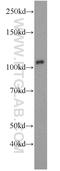 Aryl Hydrocarbon Receptor antibody, 17840-1-AP, Proteintech Group, Western Blot image 