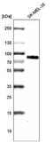 Tyrosinase Related Protein 1 antibody, NBP2-61142, Novus Biologicals, Western Blot image 