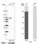 Plakophilin 1 antibody, NBP1-90041, Novus Biologicals, Western Blot image 