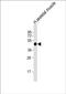 Hydroxylysine Kinase antibody, PA5-49475, Invitrogen Antibodies, Western Blot image 