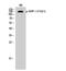 Inositol Polyphosphate-5-Phosphatase D antibody, A03358Y1021, Boster Biological Technology, Western Blot image 