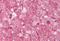 MINK1 antibody, NBP1-02336, Novus Biologicals, Immunohistochemistry frozen image 
