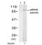 Ribosomal Protein S6 Kinase A1 antibody, GTX78975, GeneTex, Western Blot image 