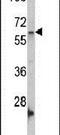 G Protein Nucleolar 3 antibody, PA5-11440, Invitrogen Antibodies, Western Blot image 