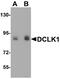 Doublecortin Like Kinase 1 antibody, A03089, Boster Biological Technology, Western Blot image 
